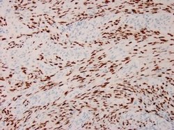ORF73/HHV8 Antibody (HHV8/3633R) - Azide and BSA Free, Novus Biologicals 100 &mu;g | Buy Online | Novus Biologicals | Fisher Scientific